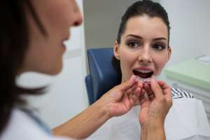 Adult Orthodontics with Crowns or Implants: Make a Plan That Works Adult Orthodontics with Crowns or Implants: Make a Plan That Works